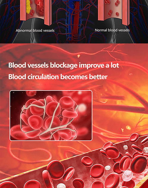 blood-vessel-blockage-improvement-image