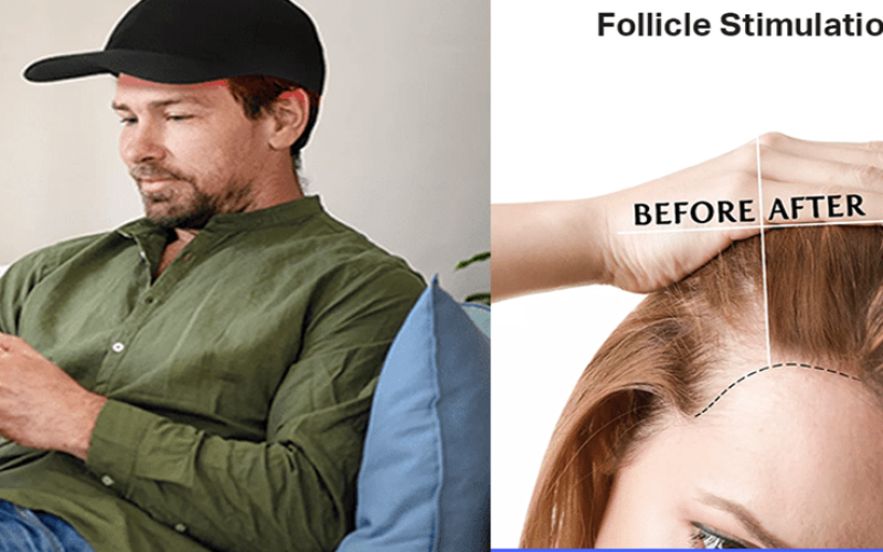 Hair Loss Therapy - at home -image